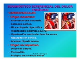 Semiología de la Angina de Pecho