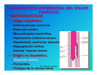 Semiología de la Angina de Pecho