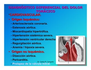 Semiología de la Angina de Pecho