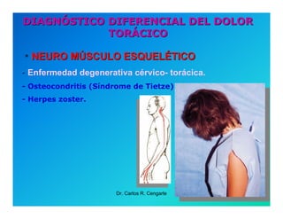 Semiología de la Angina de Pecho