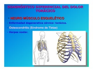 Semiología de la Angina de Pecho