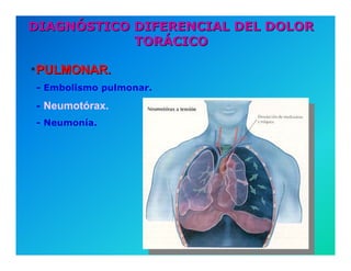 Semiología de la Angina de Pecho