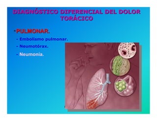 Semiología de la Angina de Pecho