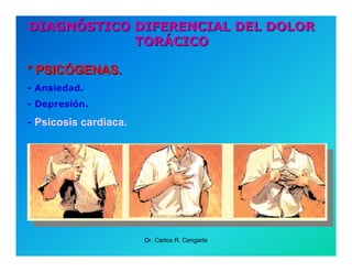 Semiología de la Angina de Pecho