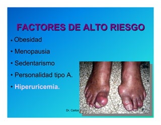 Semiología de la Angina de Pecho