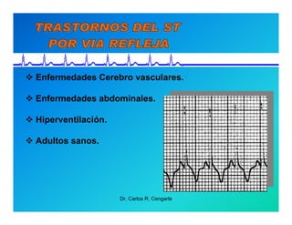 Semiología de la Angina de Pecho