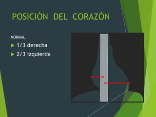 POSICIÓN DEL CORAZÓN
NORMAL
 1/3 derecha
 2/3 izquierda
 