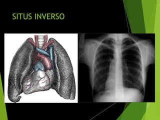 SITUS INVERSO
 