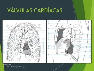 VÁLVULAS CARDÍACAS
MoelleryReif
PocketAtlasof RadiographicAnatomy
 