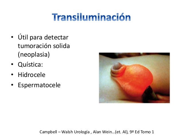 Testiculo en ascensor pdf download