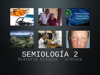 SEMIOLOGÍA 2Historia Clínica - Crónica
 