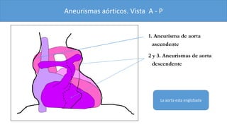 Semiología cardiaca | PPTX