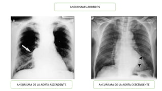 Semiología cardiaca | PPTX