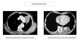 Semiología cardiaca | PPTX