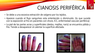 SEMIOLOGIA CARDIACA | PPTX