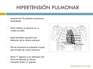 Palpable P2 Semiología cardiovascular | PDF