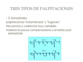 TRES TIPOS DE PALPITACIONES

• 3. Extrasístoles:
palpitaciones "instantáneas" y "fugaces".
frecuencia y cadencia muy variables
molesta la pausa compensadora o el latido post
  extrasístole
 