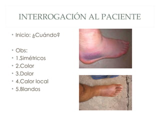INTERROGACIÓN AL PACIENTE

• Inicio: ¿Cuándo?

•   Obs:
•   1.Simétricos
•   2.Color
•   3.Dolor
•   4.Calor local
•   5.Blandos
 