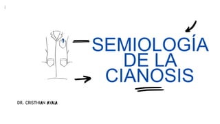 SEMIOLOGÍA
DE LA
CIANOSIS
DR. CRISTHI N Y L
 