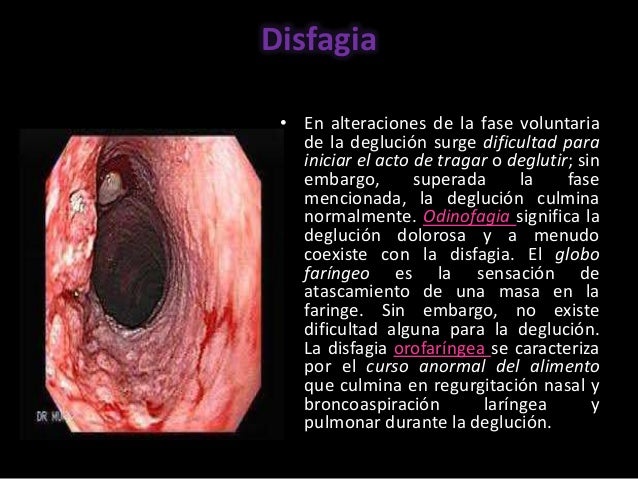 La causa de los dolores en los riñones a los hombres de la causa