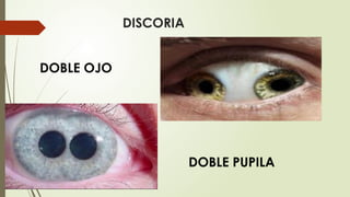SEMIOLOGÍA DE LA VISIÓN MEDICINA PARA ESTUDIANTES | PPTX