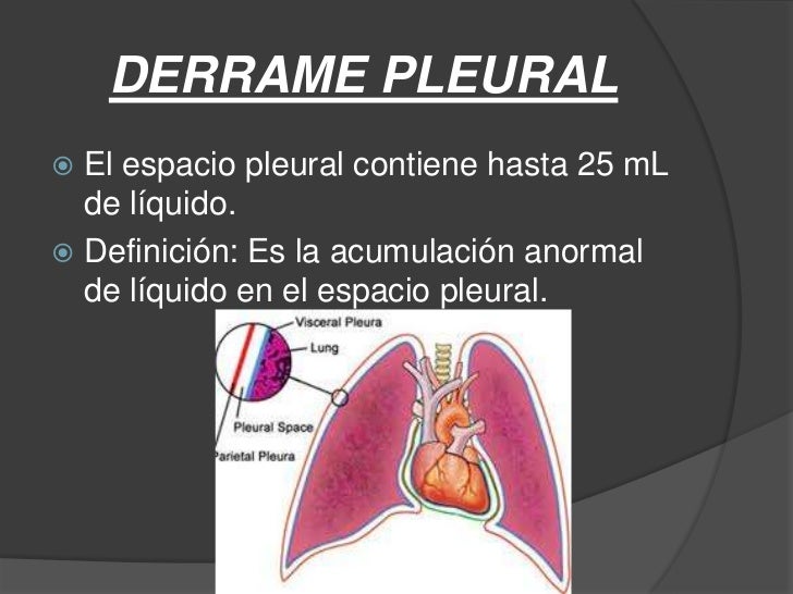 Semiología del edema y derrame pleural