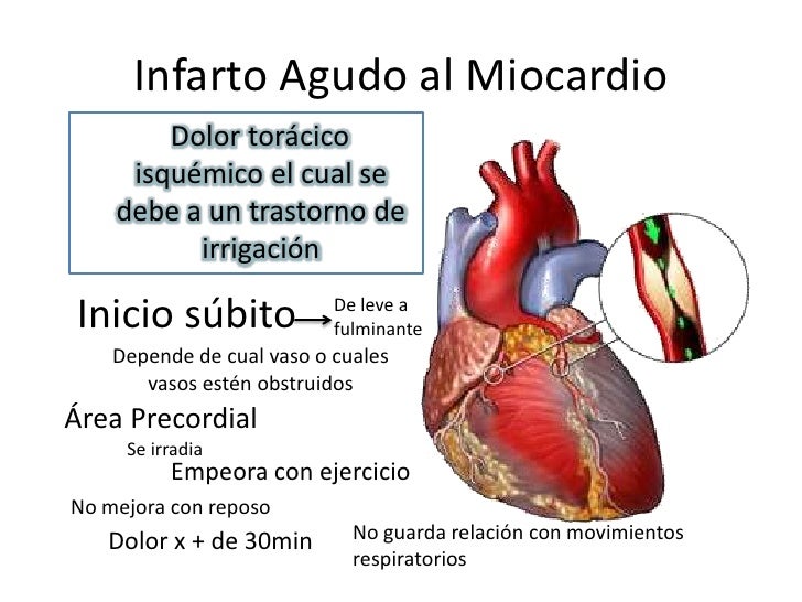 Infarto Agudo Do Miocardio