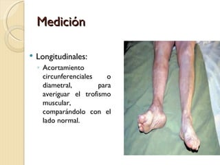 Medición

   Longitudinales:
    ◦ Acortamiento
      circunferenciales    o
      diametral,        para
      averiguar el trofismo
      muscular,
      comparándolo con el
      lado normal.
 