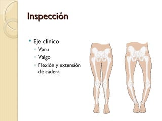 Inspección

   Eje clinico
    ◦ Varu
    ◦ Valgo
    ◦ Flexión y extensión
      de cadera
 