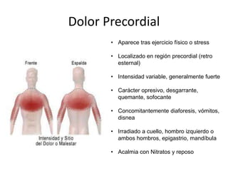 Dolor PrecordialAparece tras ejercicio físico o stress