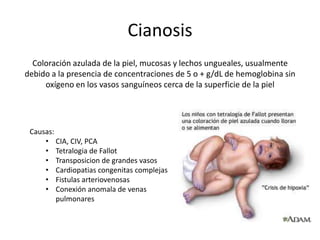 Carácter opresivo, desgarrante, quemante, sofocante
