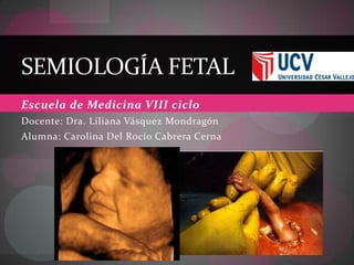 SEMIOLOGÍA FETAL
Escuela de Medicina VIII ciclo
Docente: Dra. Liliana Vásquez Mondragón
Alumna: Carolina Del Rocío Cabrera Cerna
 