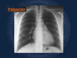 Palpación
 