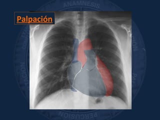 Palpación
 