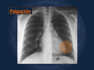 Palpación
 