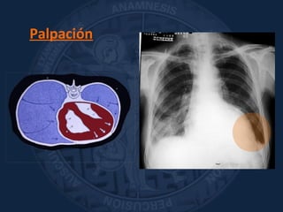 Palpación
 