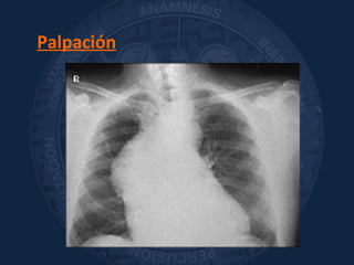 Palpación
 