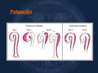 Palpación
 