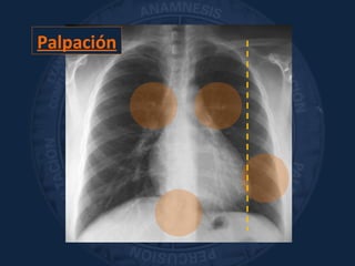 Palpación
 
