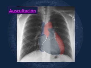 Auscultación
 