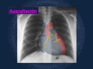 Auscultación
 