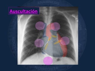 Auscultación
 
