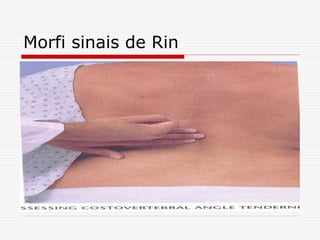 Morfi sinais de Rin
 