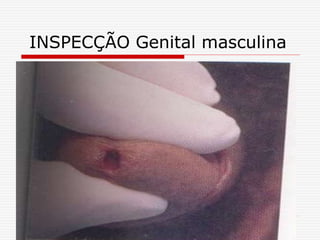 INSPECÇÃO Genital masculina
 