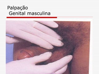 Palpação
Genital masculina
 