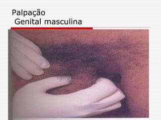 Palpação
Genital masculina
 
