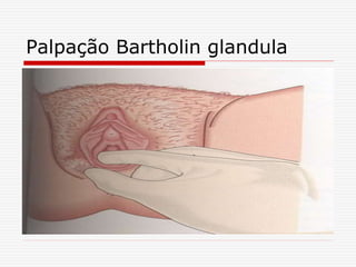 Palpação Bartholin glandula
 