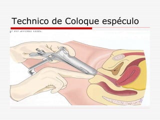 Technico de Coloque espéculo
 