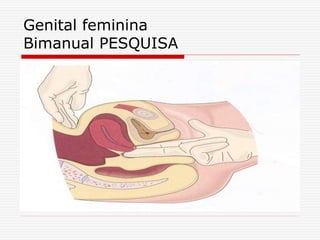 Genital feminina
Bimanual PESQUISA
 