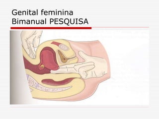 Genital feminina
Bimanual PESQUISA
 